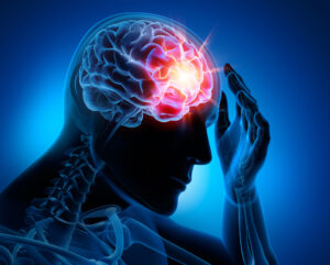 Why Choose the Law Office of Michael J. Tremoulis After a Brain Injury in Findlay, Ohio?